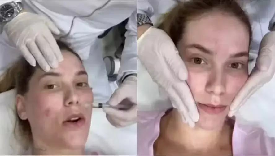 Influenciadora digital e apresentadora Virginia Fonseca experimentou o método — Foto: Reprodução Instagram
