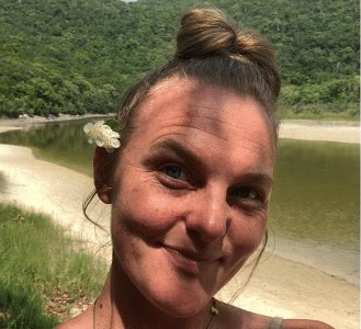Mulher se recupera após ataque de capivara enquanto nadava na Lagoa da Lagoinha do Leste, em Florianópolis; animal arrancou parte da nádega da vítima. Foto: Divulgação.