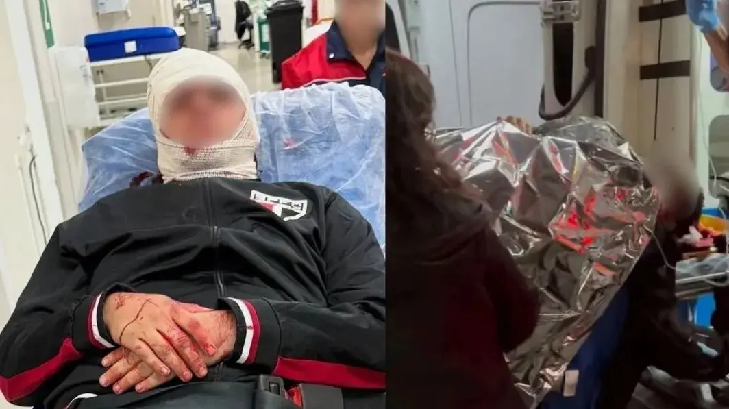 Homem, de 49 anos, sofreu um corte na cabeça e seu filho, de 17 anos, teve escoriações  - Foto: Reprodução/ Redes Sociais