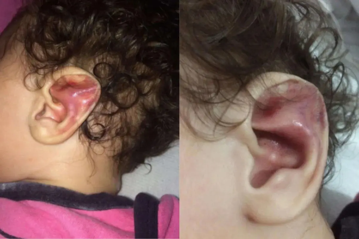 Mãe condenada por torturar bebê de 6 meses é presa; padrasto segue foragido