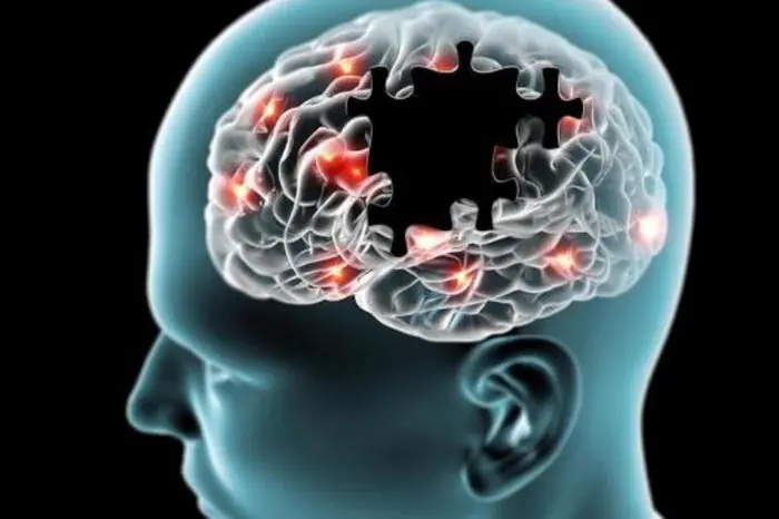 Esquecimentos e dificuldade de concentração em idosos nem sempre indicam Alzheimer e podem estar associados a quadros depressivos. Foto: Reprodução.