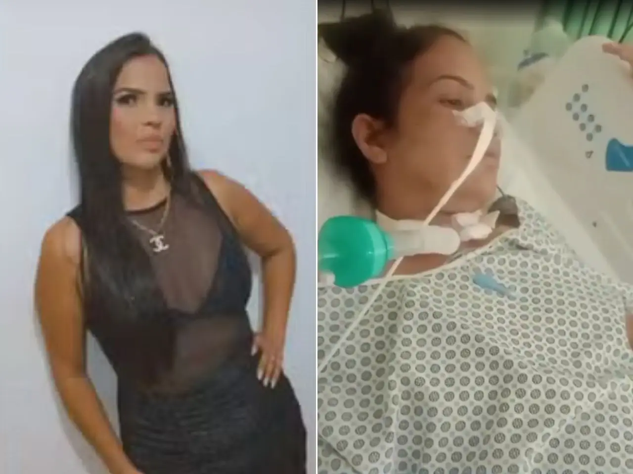 Mulher fica em estado grave após usar caneta emagrecedora do Paraguai