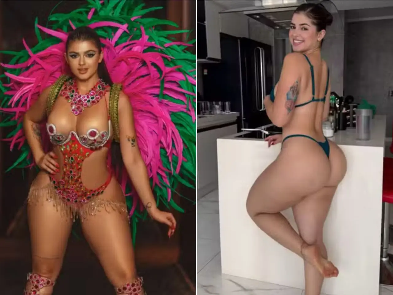 Após ser internada por usar super cola 'lá embaixo', Miss bumbum toma medida drástica