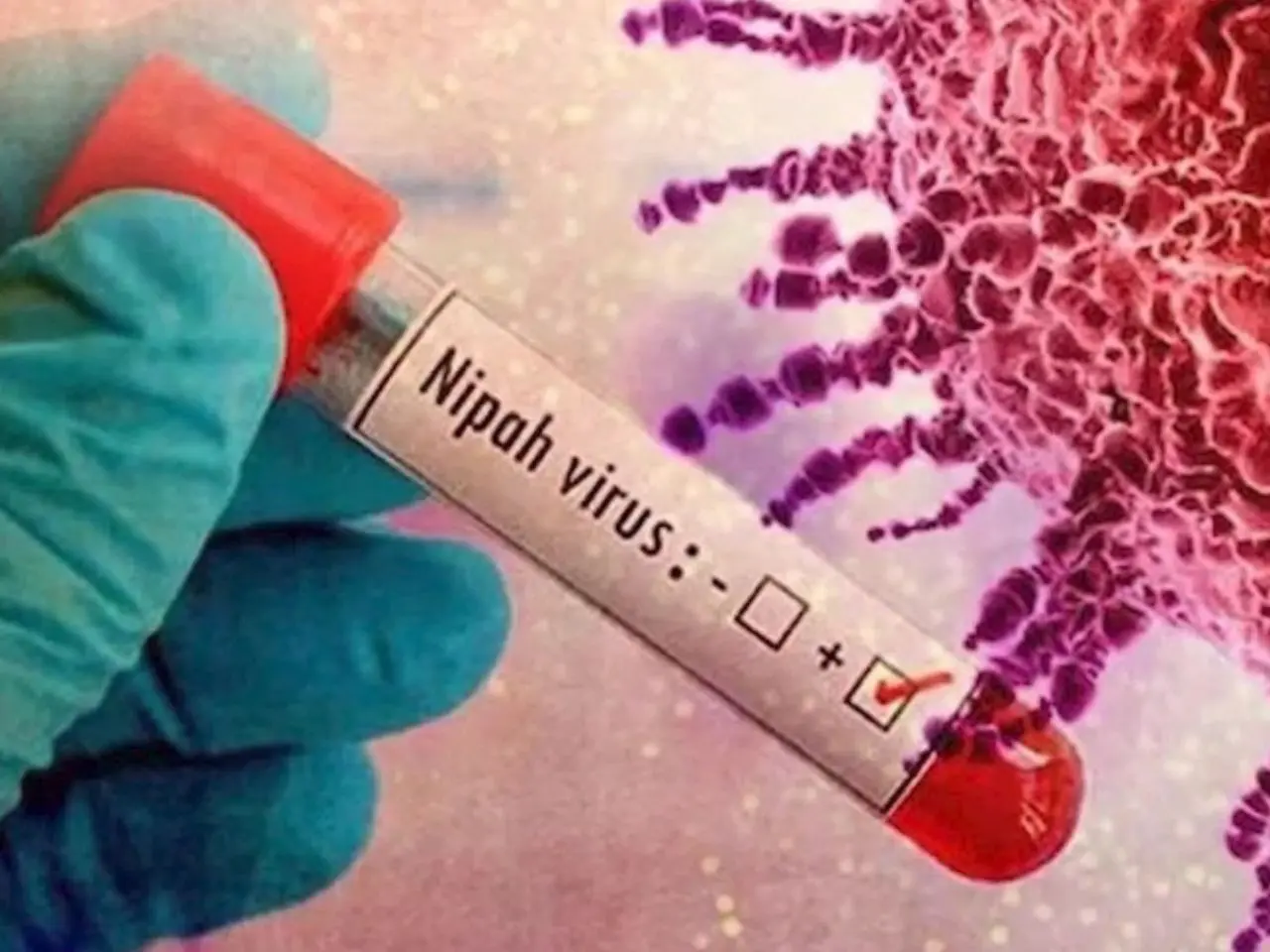 Especialistas explicam sintomas, formas de transmissão e por que o Brasil não é considerado área de risco para o vírus Nipah. Foto: Divulgação.