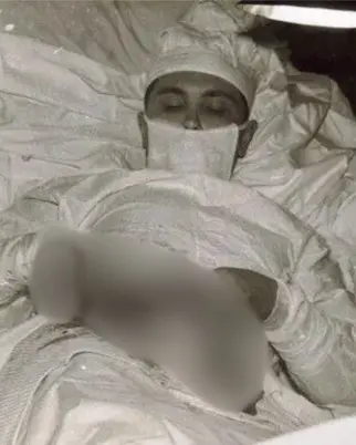 Conheça a história do médico que fez uma cirurgia em si mesmo para sobreviver