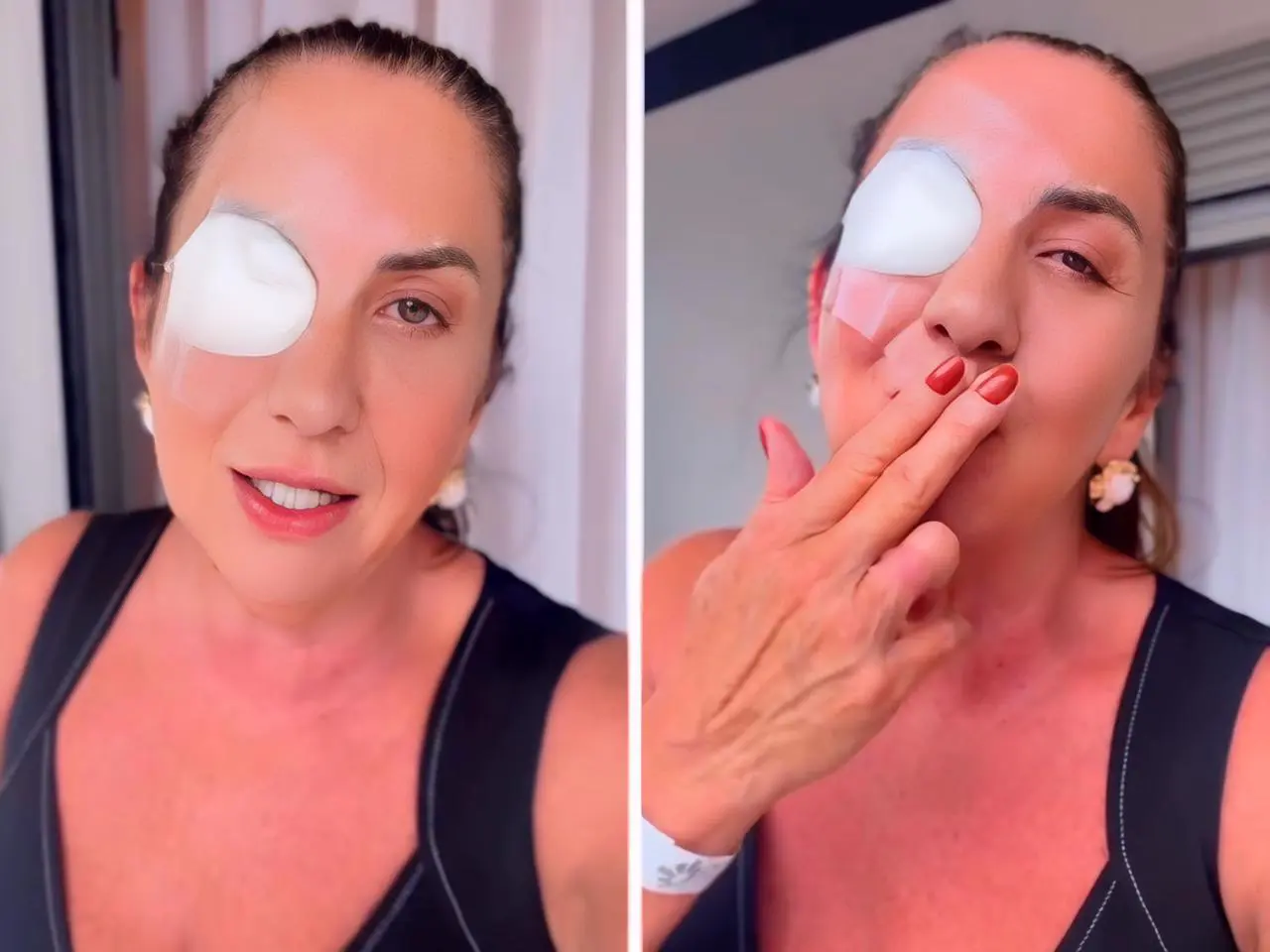 Margareth Serrão cirurgia nos olhos || Reprodução: Redes Sociais/Instagram 