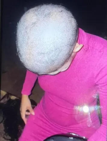 Influencer com cabeça raspada (Foto: Reprodução)