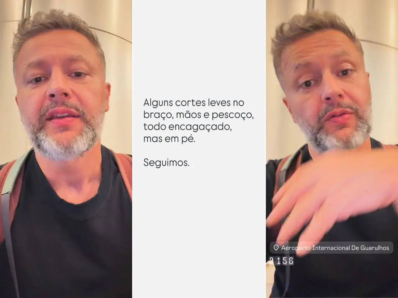 Lucas Lima fica ferido em tentativa de assalto a caminho do aeroporto em SP