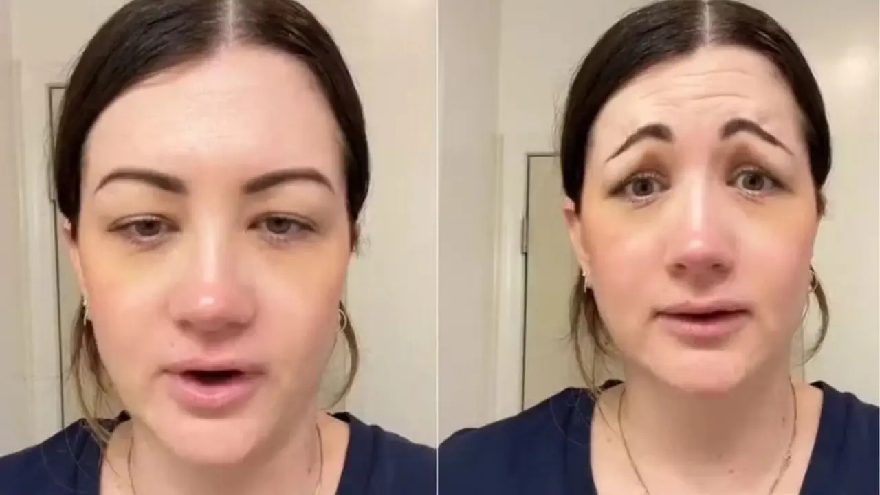 Britânica fez botox e deu errado (Reprodução/Redes Sociais)