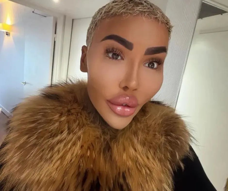 Jordan James Parke ficou conhecido nas redes sociais como o “Rei dos Lábios”. Foto: Divulgação / Redes sociais.
