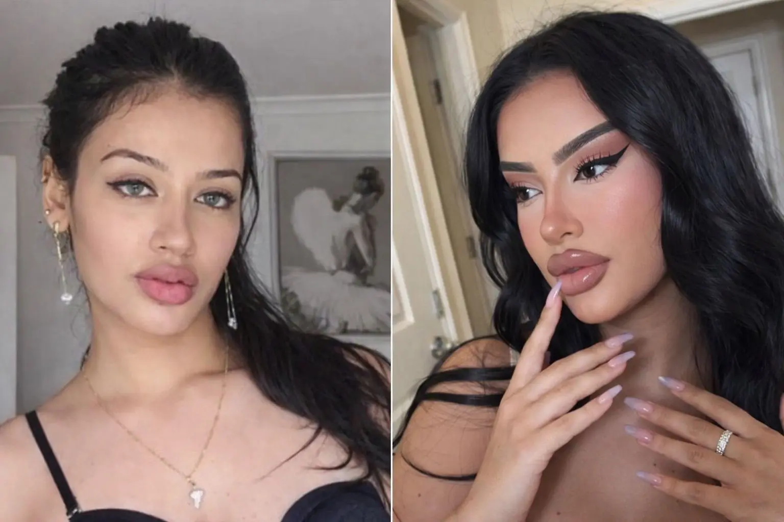 Influenciadora relata situação inusitada após fazer rejuvenescimento no rosto aos 24 anos (Foto: Redes Sociais)