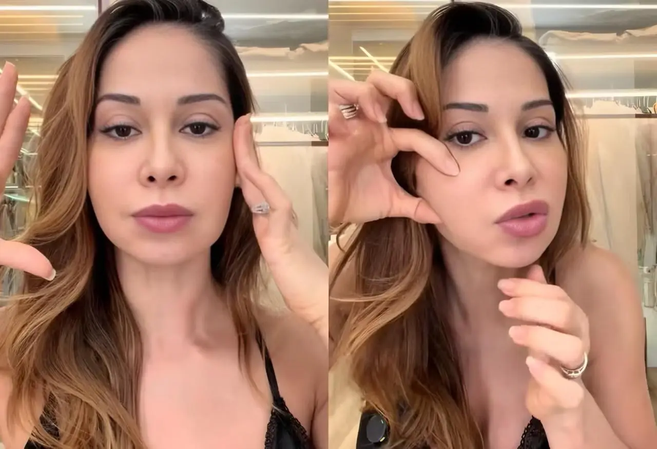 Uso de PMMA pode matar? Entenda procedimento que fará Maíra Cardi 'abrir a cara inteira' (Foto: Reprodução/Redes sociais)
