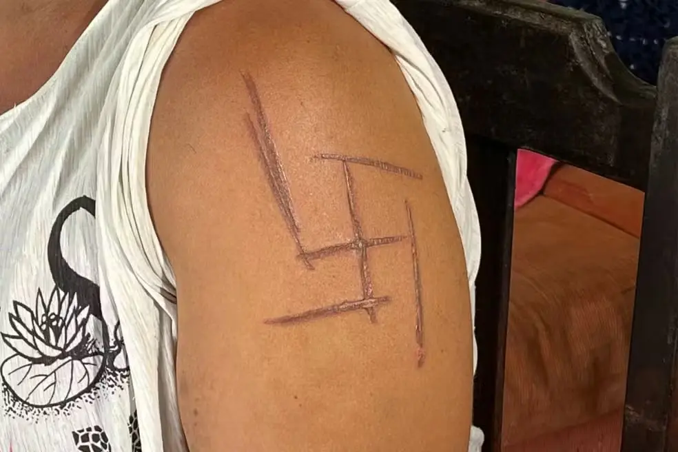 Mulher trans é marcada com símbolo nazista durante tortura:  (Foto:  TV Morena)