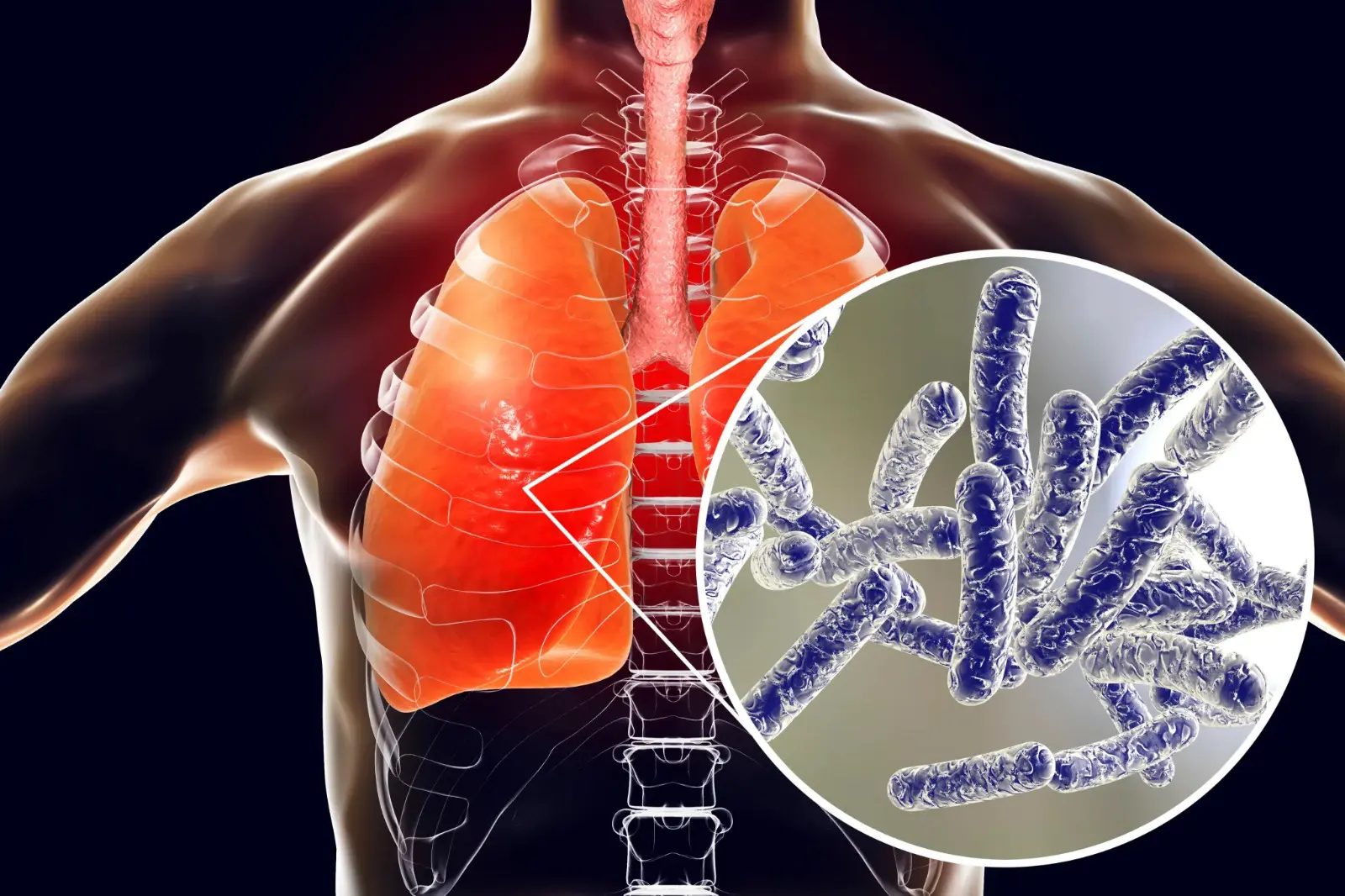 Bactéria Legionella pode se multiplicar em sistemas de água de edifícios e causar pneumonia grave. Foto: Divulgação.