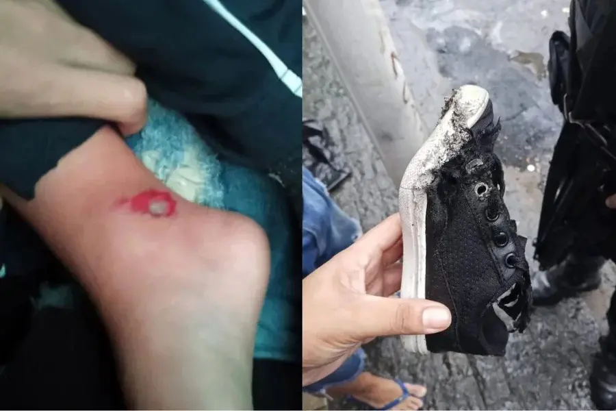 Vídeo mostra momento de tensão após criança ser atropelada por policial militar em Santos. Foto: Santa Portal.