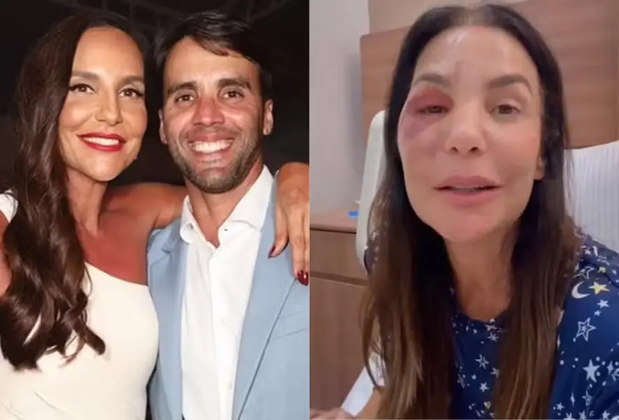 Ex-marido tranquiliza fãs e dá detalhes sobre recuperação de Ivete Sangalo após cirurgia