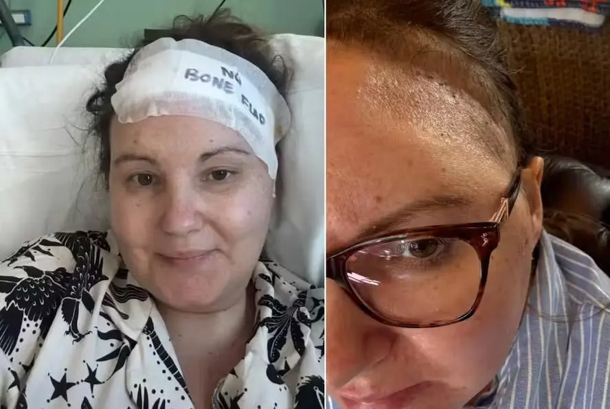 Jodie precisou operar após descobrir tumor (Foto: Brain Tumour Research)