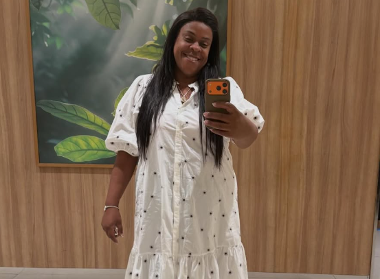 Cacau revelou complicações após utilizar pomada no cabelo (Foto: Reprodução / Redes Sociais)