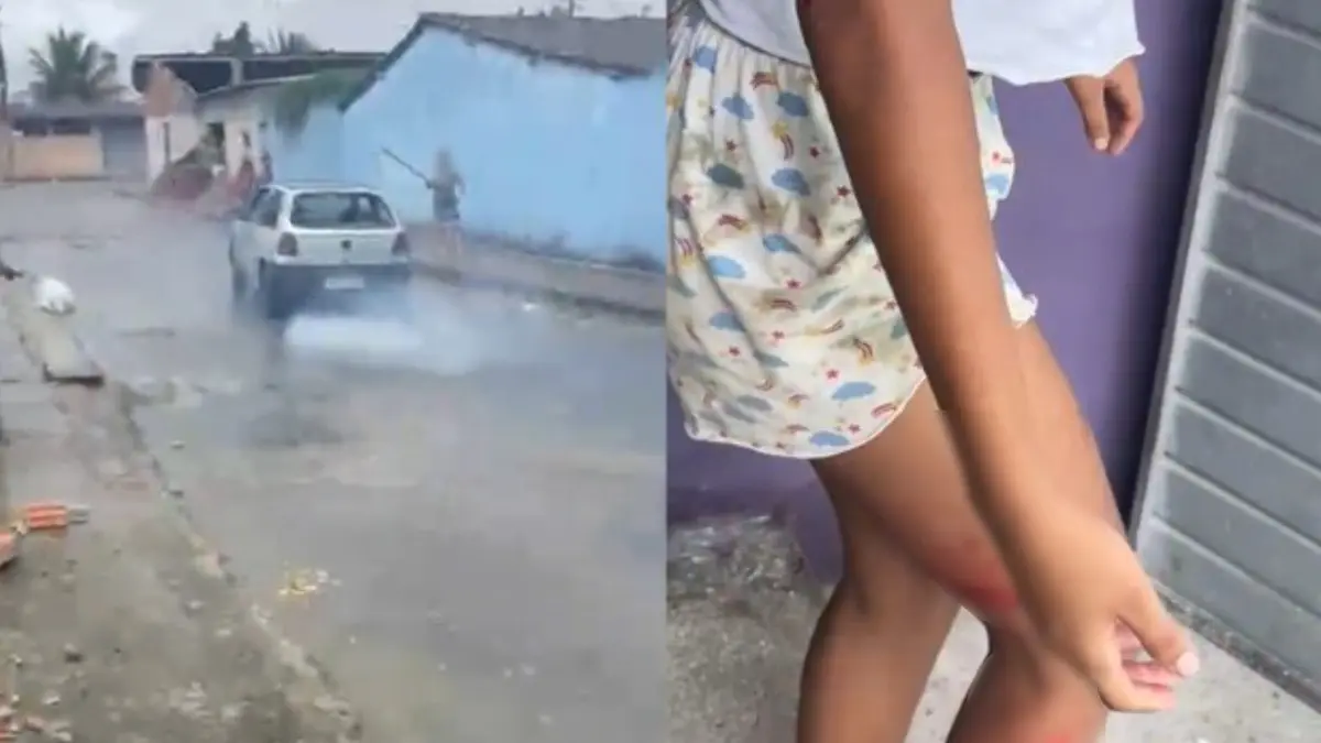 Mulher é atropelada após ex não aceitar fim da relação (Foto: Reprodução)