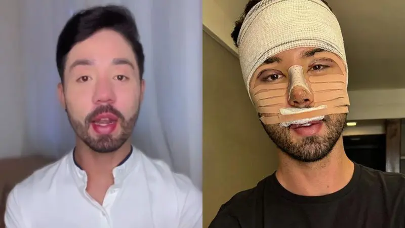 Rico Melquiades some das redes e passa por nova cirurgia estética; veja detalhes