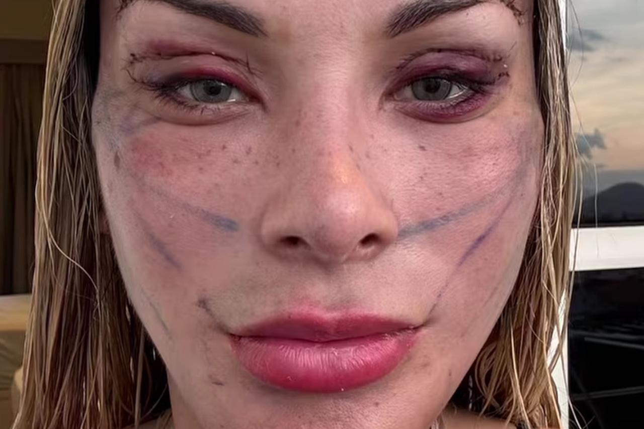 Andressa Urach