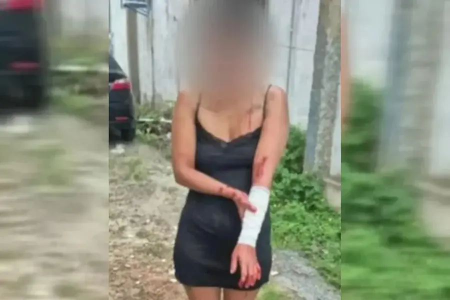 Homem invade quarto e ataca ex com facadas enquanto ela dormia