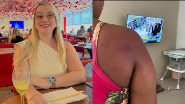 OAB pede prisão de patroa que agrediu doméstica grávida no MA; entidade classificou crime como tortura — Foto: Reprodução/Redes sociais/TV Mirante