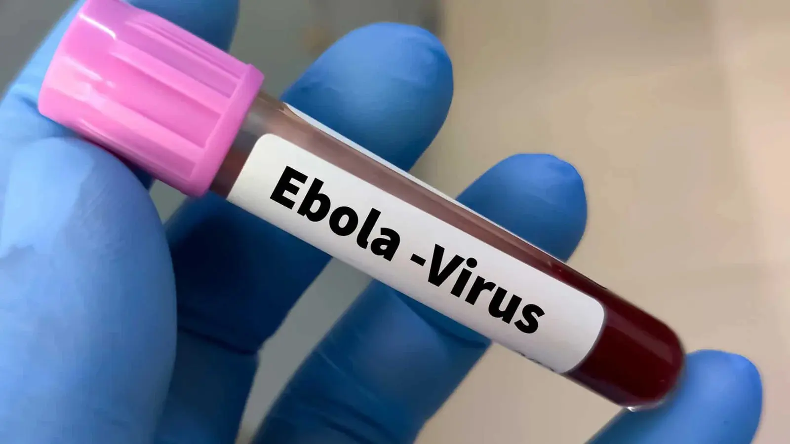 Alerta global: aumento dos casos suspeitos de ebola preocupa autoridades de saúde