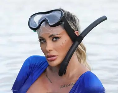 Andressa Urach passa por combo de cirurgias e revela ‘novo rosto’; veja como ficou