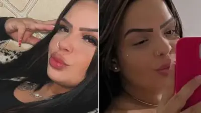 Mulher morre dias após extrair dente do siso e caso é investigado