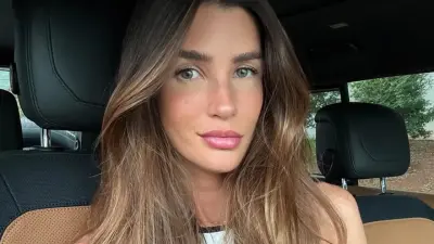 Especialistas fazem alerta após ex-BBB relatar câncer silencioso