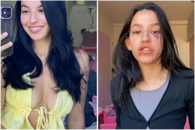Jovem relata agressão durante noite de karaokê; veja imagens