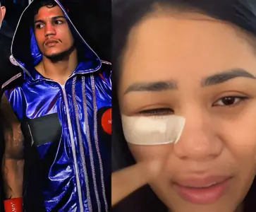 Exclusivo! Mulher que denunciou lutador de boxe por agressão quebra o silêncio