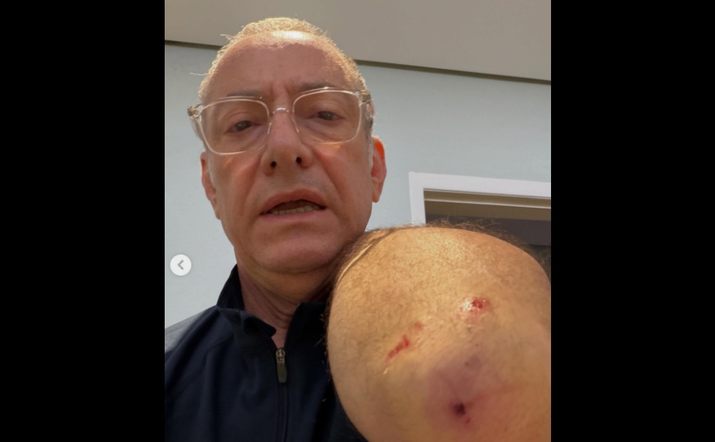 Jornalista José Roberto Burnier é atacado por pitbull. Reprodução/redes sociais
