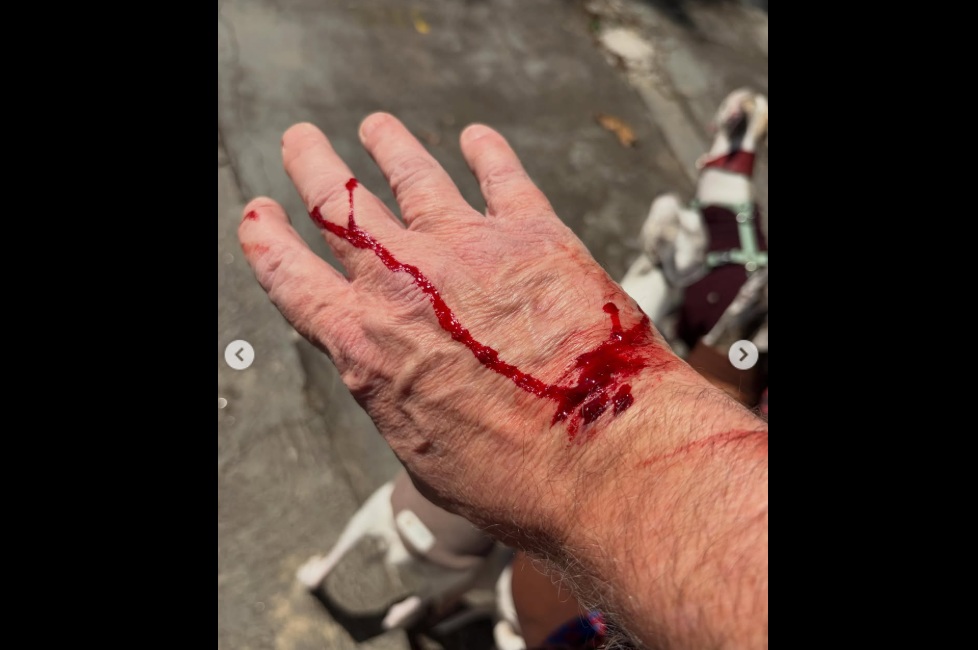 Jornalista José Roberto Burnier é atacado por pitbull. Reprodução/redes sociais