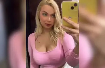 Mulher tem rosto desfigurado após ser agredida ao entrar em metrô errado; veja fotos