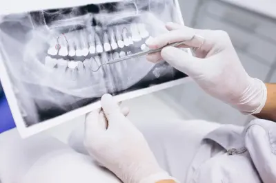 Como o uso de radiografias odontológicas permitiram o reconhecimento do cantor Oliver Tree