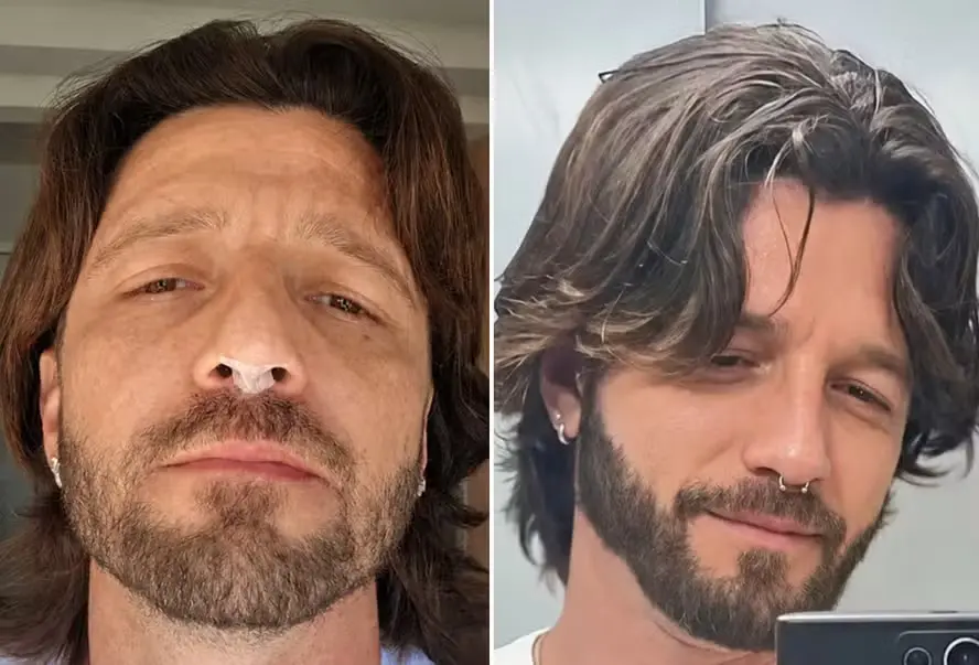 Ex-Malhação Diogo Venturieri sofre acidente com piercing durante sexo Foto: Divulgação/CO Assessoria