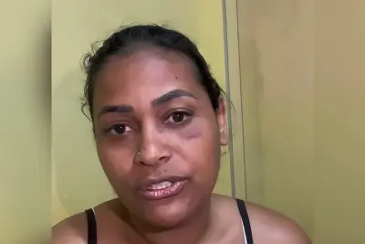 Influenciadora morde e arranca dedo de mulher após briga em festa de São João; veja vídeo