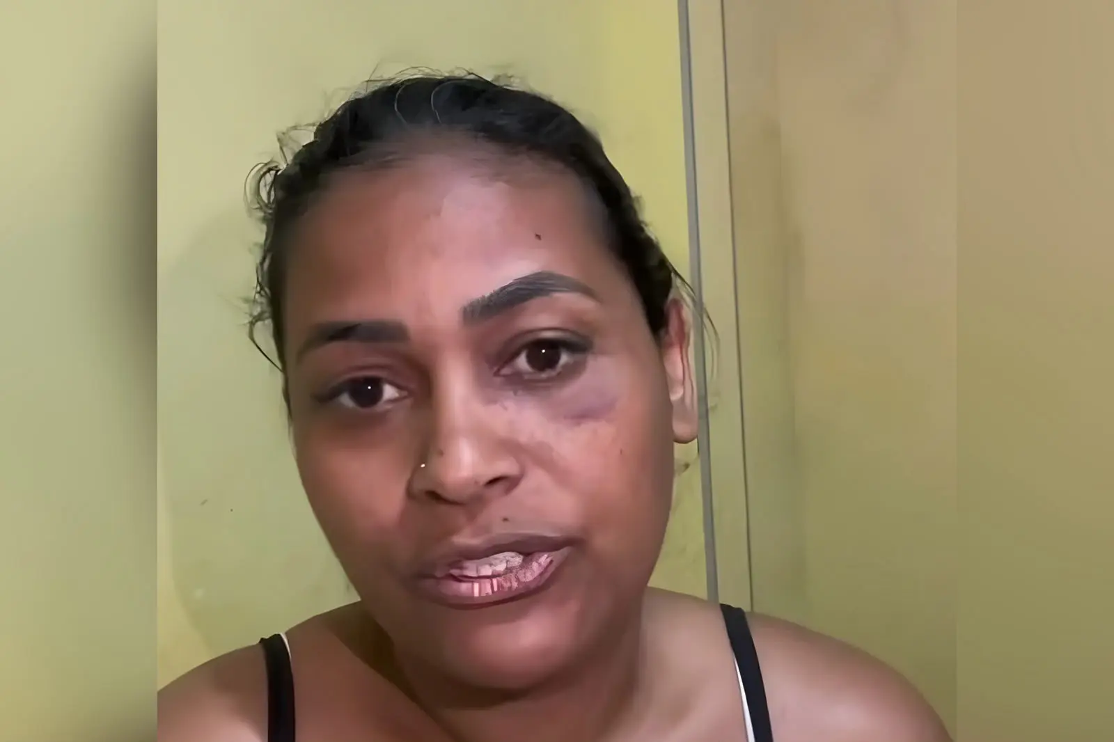 Influenciadora morde e arranca dedo de mulher após briga em festa de São João (Foto: Reprodução/Redes sociais)