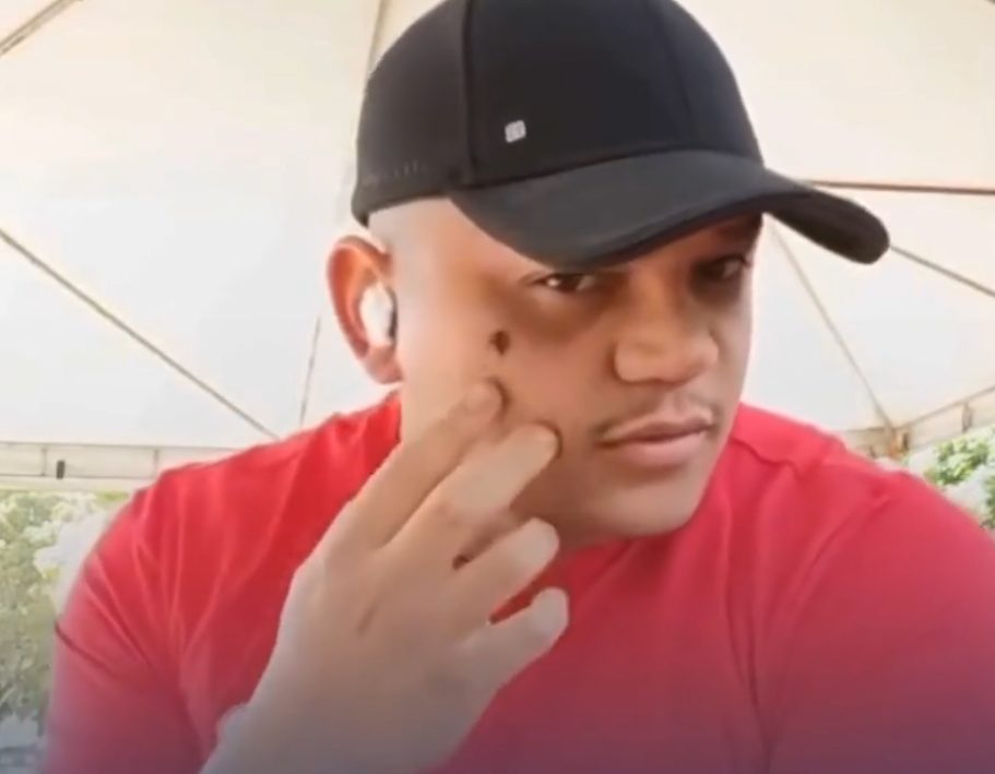 Homem atingido na cabeça disparo acidental da esposa