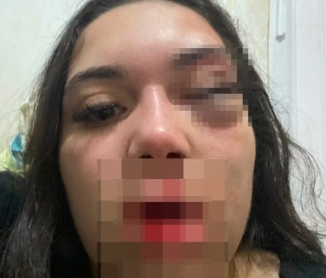 Gabriella Vitória Souza Mendes, de 19 anos Jovem foi vítima de tentativa de feminicídio